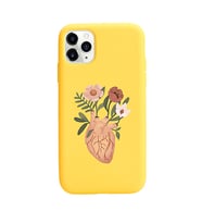 Sarı Lansman Telefon Kılıfı Iphone 11 Pro