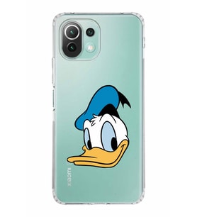 Xiaomi  Mi 11 Lite  Kamera Korumalı Kapak Donald Duck Tasarımlı Şeffaf  Kılıf
