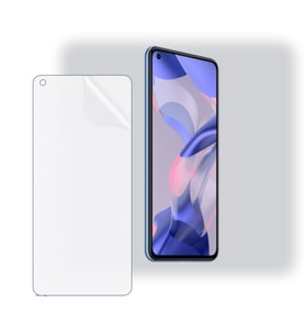 SChitec Xiaomi 11 Lite 5G Uyumlu Ön Yüzey Nano Şeffaf Hidrojel Ekran Koruyucu