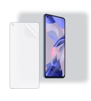 SChitec Xiaomi 11 Lite 5G Uyumlu Ön Yüzey Nano Şeffaf Hidrojel Ekran Koruyucu