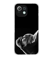 PrintiFy Xiaomi Mi 11 Lite ile Uyumlu Köpek 1 Kamera Korumalı Şeffaf Kılıf
