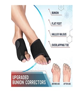 Halluks Valgus Gece Ateli Ayak Bunyon Kemik Koruyucu 1 Çift (sağ Ve Sol)