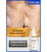 Siyah Nokta Gözenek Sıkılaştırıcı Vivo Series A210