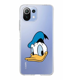 Xiaomi Mi 11 Lite Uyumlu Kapak Donald Duck Tasarımlı Şeffaf Silikon Kılıf