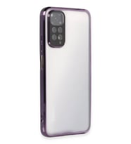 Newface Xiaomi Redmi Note 11 Kılıf Razer Lensli Silikon - Mor