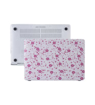 MacBook Air Kılıf HardCase A1369 A1466 2017 Öncesi Uyumlu Koruyucu Kılıf QT01 (Açık Pembe)