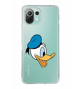 Xiaomi  Mi 11 Lite  Kamera Korumalı Kapak Donald Duck Tasarımlı Şeffaf  Kılıf