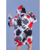 Toontoy Kız Çocuk Batik Desenli Baskılı Elbise (Kırmızı)