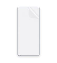 SChitec HONOR Magic5 Lite Uyumlu Ön Yüzey Nano Şeffaf Hidrojel Ekran Koruyucu
