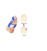 başarı ortopedi Ayak Baş Parmak Parmağı Kemik Kemiği Çıkıntısı Için Aparat Atel Halluks Valgus Bunyon 2 Adet