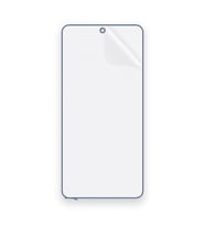 SChitec Xiaomi Note10S Uyumlu Ön Yüzey Nano Şeffaf Hidrojel Ekran Koruyucu