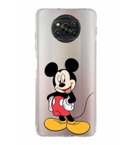 Xiaomi  Poco X3 Pro  Kamera Korumalı Kapak Mickey Mouse Tasarımlı Şeffaf  Kılıf