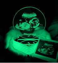 Ultrason Fotoğraflı 3D LED Lamba - Hamile Eşe ve Anne Adayına Hediye