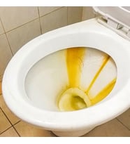 FRESHINE PLUS Konsante Tuvalet, Banyo Temizleyici ve Koku Giderici - 10 Kg