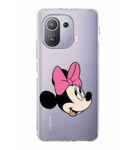 Xiaomi  Mi 11 Pro  Kamera Korumalı Kapak Minnie Mouse Tasarımlı Şeffaf  Kılıf