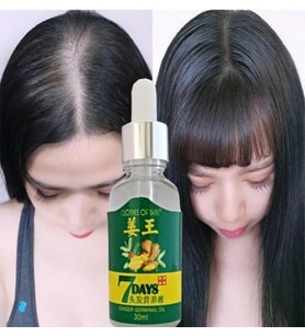 7Days 30ML Gingergerminalessentialoil Hair Growth Loss Treatment Serum Unisex 3 Adet Saç Bakım Yağı