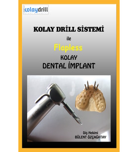 Kolay Drill Sistemi ile Flapless Kolay İmplant - Özçağatay Yayıncılık