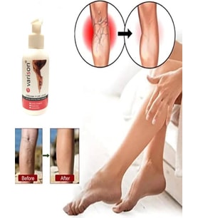Süper On Sellülit 120 ml