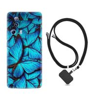 Xiaomi Mi 13 Lite Kılıf Resimli Boyun Askılı İpli Desenli Silikon Owl 1351