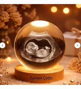Kişiye Özel 3D Ultrason Bebek Görüntüsü Kristal Cam Küre