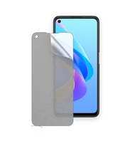 SChitec OPPO A76 Uyumlu Ön Yüzey Mat Hidrojel Ekran Koruyucu