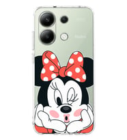Xiaomi Redmi Note 13 Mouse Desenli Şeffaf Telefon Kılıfı