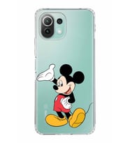 Xiaomi  Mi 11 Lite  Kamera Korumalı Kapak Mickey Mouse Tasarımlı Şeffaf  Kılıf