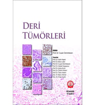 Deri Tümörleri