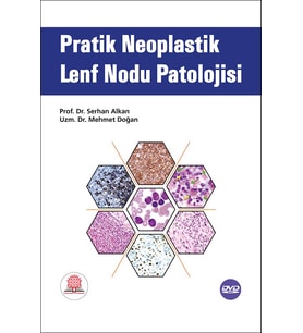 Pratik Neoplastik Lenf Nodu Patolojisi