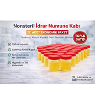 Nonsteril İdrar Numune Kabı 100 Ml Sızdırmaz Kapaklı Steril Olmayan Numune Kabı Laboratuvar Kullanı