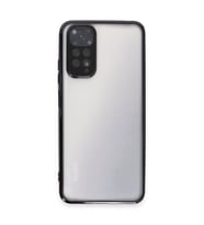 Xiaomi Redmi Note 11 Kılıf Razer Lensli Silikon - Siyah