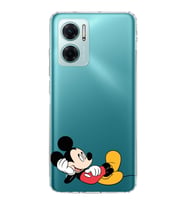 Redmi Note 11e  Kamera korumalı Kapak Mickey Mouse Tasarımlı  Şeffaf Kılıf