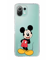 Xiaomi  Mi 11 Lite  Kamera Korumalı Kapak Mickey Mouse Tasarımlı Şeffaf  Kılıf