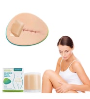 Soft Silikon Bant Yara Dikiş Ameliyat Izi Giderici Sezaryen Yanık Estetik Keloid 4cm X 1,5mt