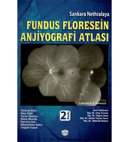 Fundus Floresein Anjiyografi Atlası
