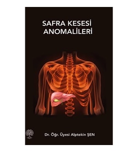 Safra Kesesi Anomalileri
