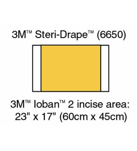 Ioban 2 - İnsizyon Örtüsü - 56 Cm X 45 Cm