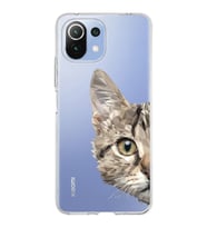 Xiaomi Mi 11 Lite Uyumlu Kapak Catface Tasarımlı Şeffaf Silikon Kılıf