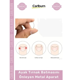 Özel Üretim Paslanmaz Çelik Ergonomik Tırnak Düzeltici Seti Ayak Tırnak Batmasını Önleyen Metal Apar