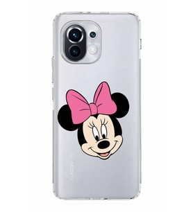 Xiaomi  Mi 11  Kamera Korumalı Kapak Minnie Mouse Tasarımlı Şeffaf  Kılıf