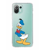 Xiaomi  Mi 11 Lite  Kamera Korumalı Kapak Donald Duck Tasarımlı Şeffaf  Kılıf
