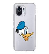 Xiaomi  Mi 11  Kamera Korumalı Kapak Donald Duck Tasarımlı Şeffaf  Kılıf