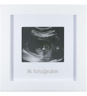 İlk Fotoğrafım Bebek Ultrason Çerçevesi - Bebek Odası Resim Anı Çerçevesi