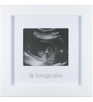 İlk Fotoğrafım Bebek Ultrason Çerçevesi - Bebek Odası Resim Anı Çerçevesi