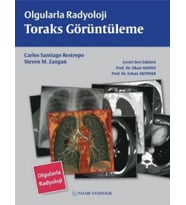 Olgularla Radyoloji Toraks Görüntüleme (Krem)