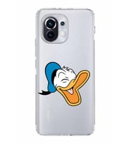 Xiaomi  Mi 11  Kamera Korumalı Kapak Donald Duck Tasarımlı Şeffaf  Kılıf