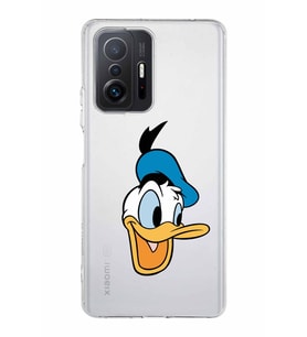 Xiaomi  Mi 11T Pro  Kamera Korumalı Kapak Donald Duck Tasarımlı Şeffaf  Kılıf