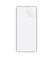 SChitec Redmi Note 12 Discovery Uyumlu Ön Yüzey Nano Şeffaf Hidrojel Ekran Koruyucu