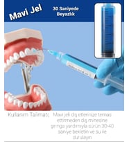 Mavi Jel Diş Beyazlatıcı, 30 Saniyede Mükemmel Beyazlık