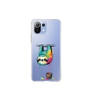 Xiaomi Mi 11 Lite ile Uyumlu Splash Tembel Hayvan Tasarımlı Şeffaf Silikon Kılıf